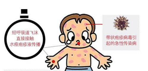 科普 | 水痘疫苗为什么要接种两剂？