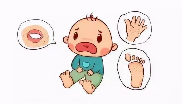 儿童手足口病的防治和居家护理